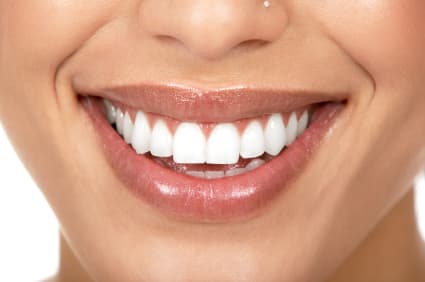 Benefits to Improving Your Teeth with Non-Metal Implants in Spokane