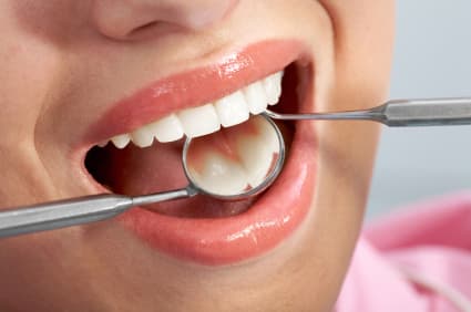 Answering the Frequently Asked Questions About Dental Sealants in Spokane, WA