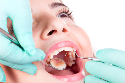Curious About What EMAX Crowns Are? Here’s What You Need to Know!