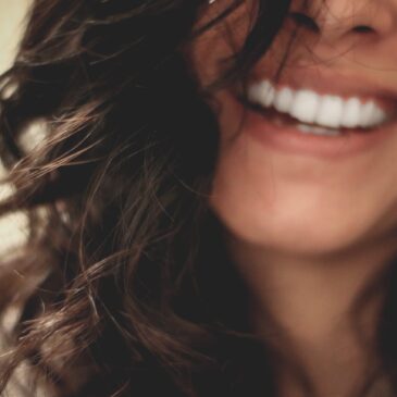 What to Expect with Dental Veneers in Spokane, WA
